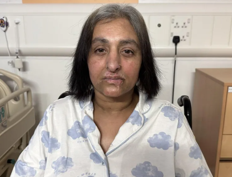 Igrala se sa psom pa pala u komu: Amputirani su joj svi udovi, a uzrok je šokantan