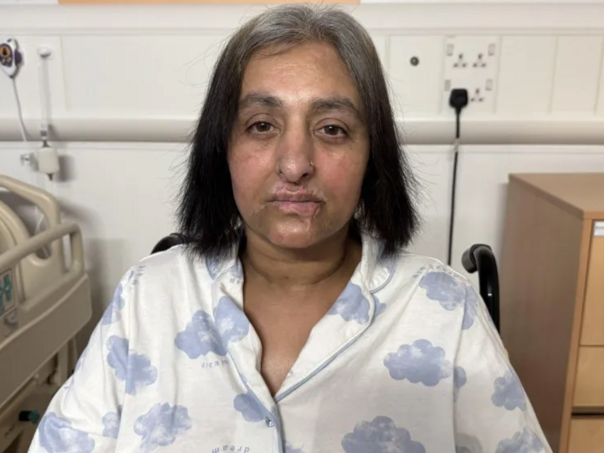 Igrala se sa psom pa pala u komu: Amputirani su joj svi udovi, a uzrok je šokantan