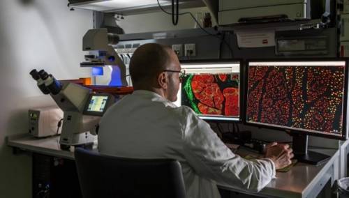 'Inclisiran' novi revolucionarni lijek za snižavanje holesterola u krvi