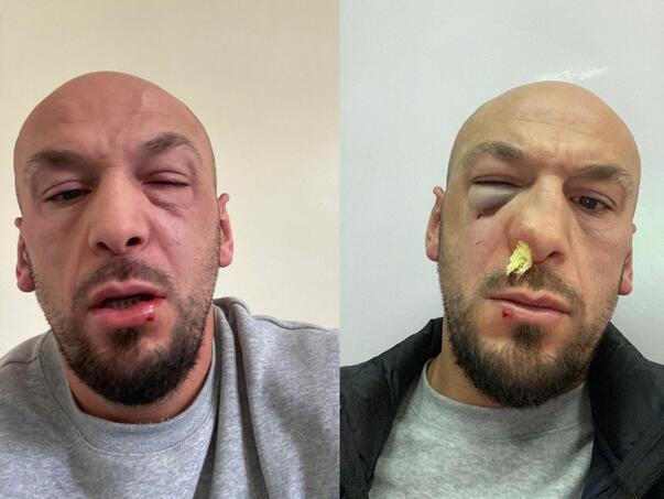 Iron Puki napadnut u centru Sarajeva, tvrdi da mu je to učinio Adnan Redžović