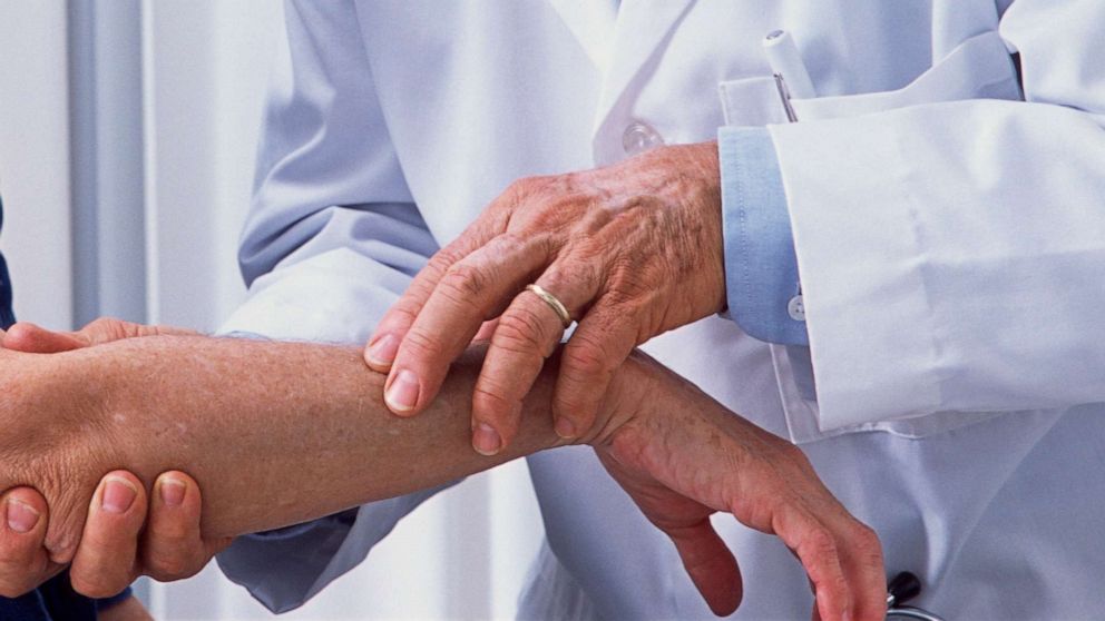 Istraživači otkrili koliko virus korona ostaje na koži