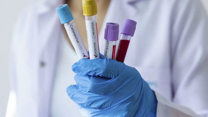 Italijanski ljekar na odmoru u Španiji pozitivan na koronavirus