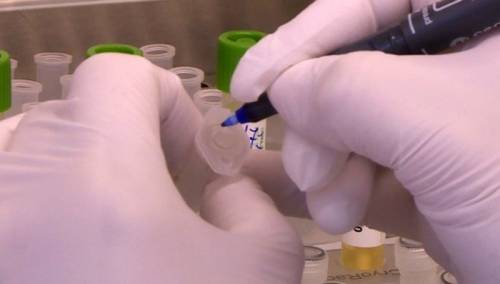 Izolovan virus Covid-19 u zagrebačkoj klinici za infektivne bolesti