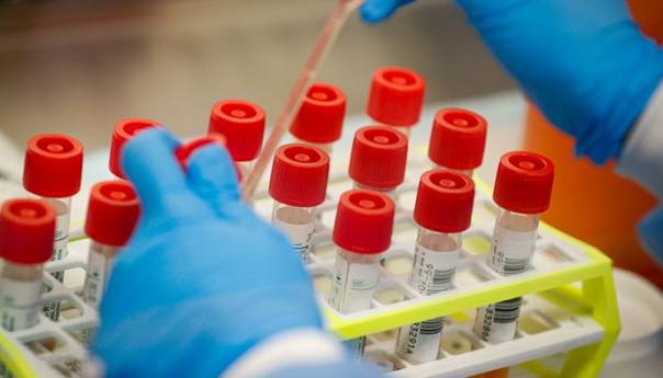 Izvršena ukupno 2.923 laboratorijska testiranja na koronavirus u RS