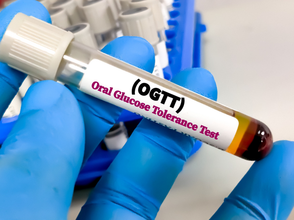 Jednostavan test u ranoj trudnoći može otkriti rizik od dijabetesa kod trudnica