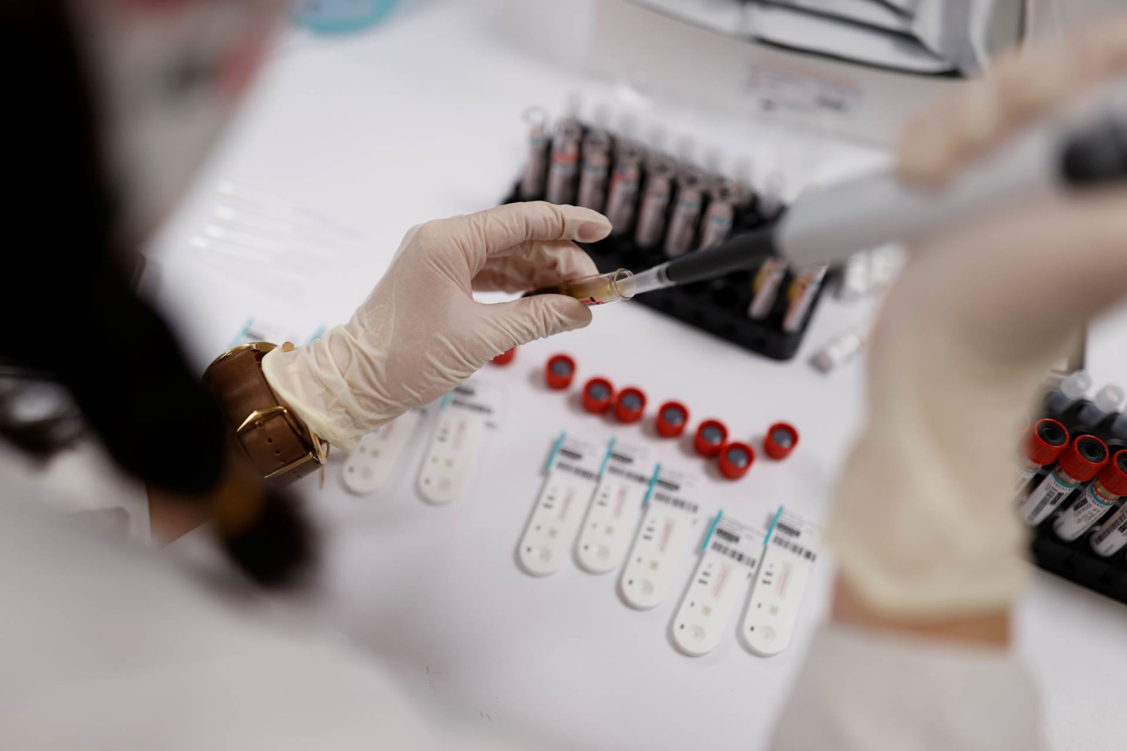 Još četiri osobe zaražene koronavirusom u FBIH