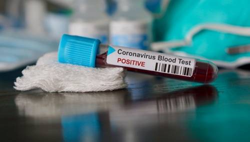 Još dvoje zaraženih koronavirusom, osobe iz Zenice i Zavidovića