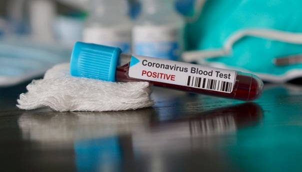 Još dvoje zaraženih koronavirusom, osobe iz Zenice i Zavidovića