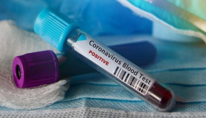 Još dvoje zaraženih koronavirusom u RS-u