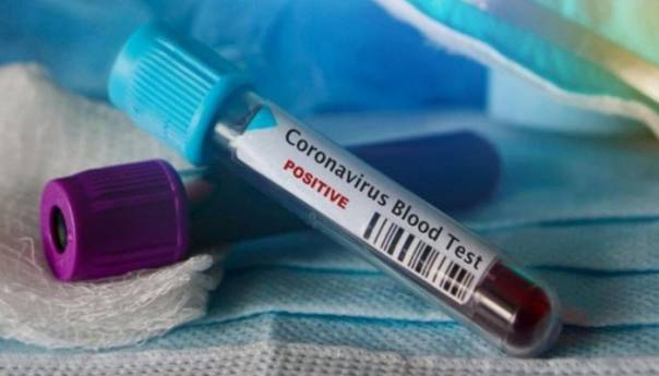 Još dvoje zaraženih koronavirusom u RS-u