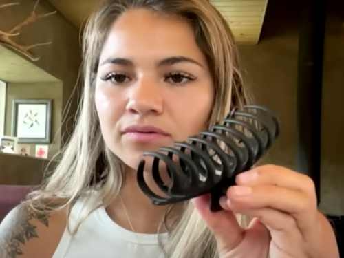 Kanađanku napao medvjed, preživjela je s 30 šavova: "Spasila me kopča za kosu"