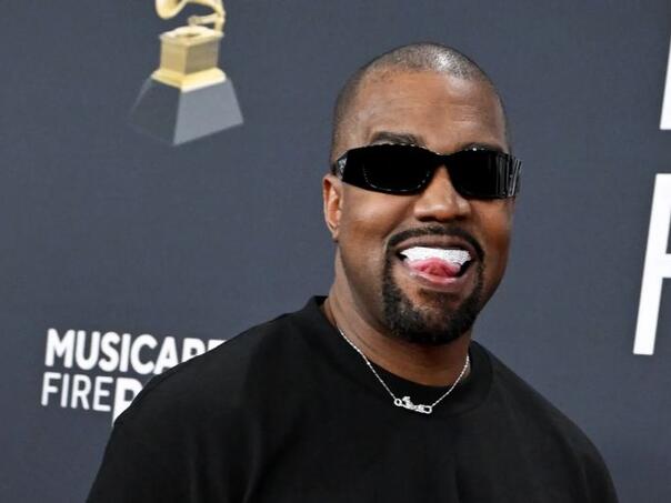 Kanye West najavio tužbu protiv zubara: 'Navukao me na plin'