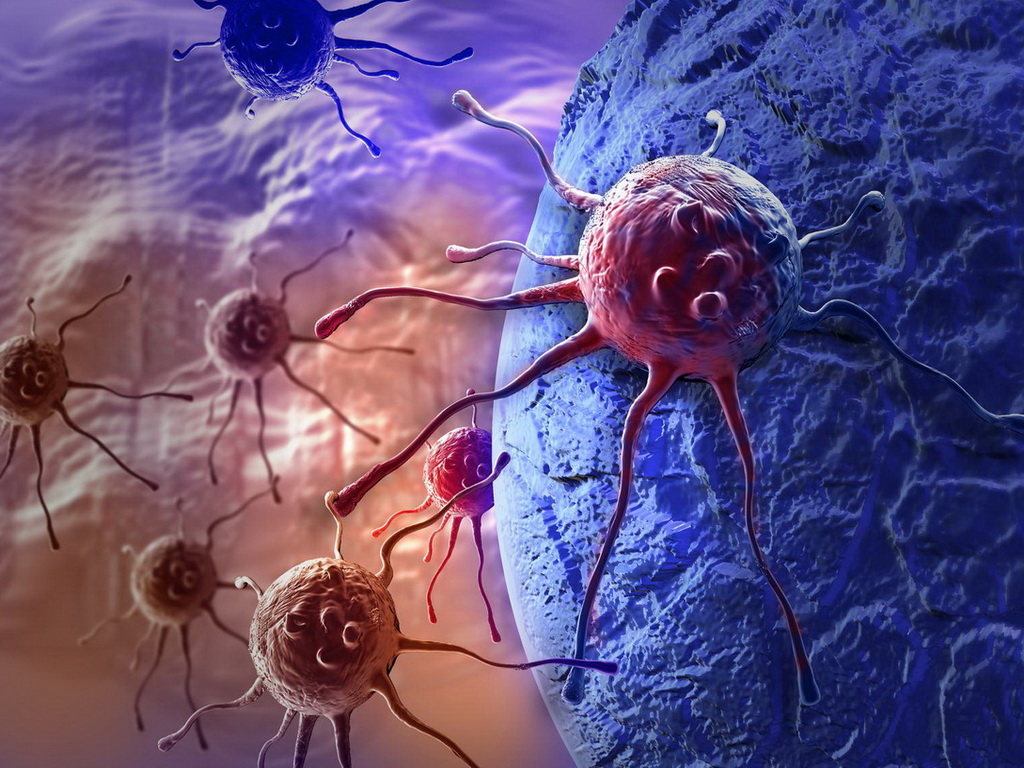 Karcinom debelog crijeva treći po učestalosti kod muškaraca i žena