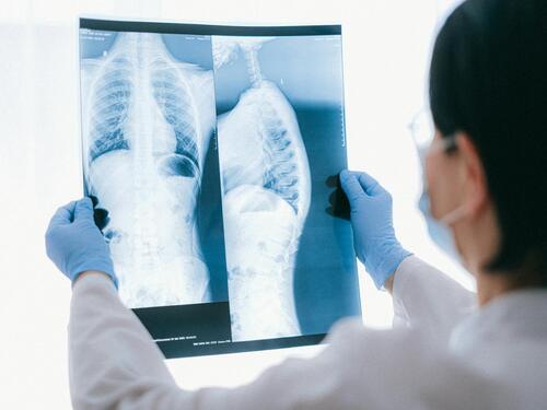 Karcinomi pluća, prostate i mokraćnog mjehura vodeći uzroci smrti kod muškaraca
