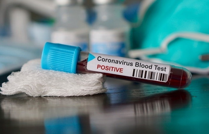 Kćerka i zet zaražene Zeničanke pozitivni na koronavirus