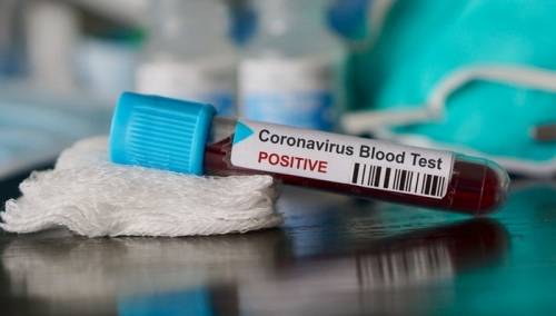 Kćerka i zet zaražene Zeničanke pozitivni na koronavirus