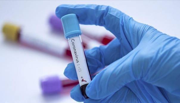 KCUS: 16 zaraženih koronavirusom u posljednja 24 sata