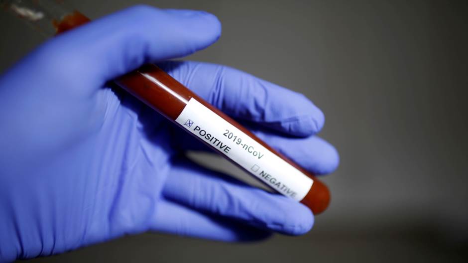 KCUS: Pacijent iz Bihaća pozitivan na koronavirus