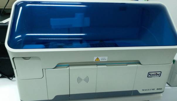 KCUS: Prvi na Balkanu pustili u rad aparat za serološku analizu antitijela na koronavirus