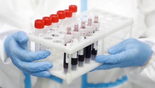 KCUS: Testirana 134 uzorka, 21 pozitivan