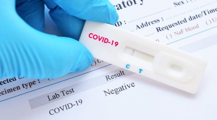 KCUS: U Sarajevu još 31 osoba pozitivna na koronavirus