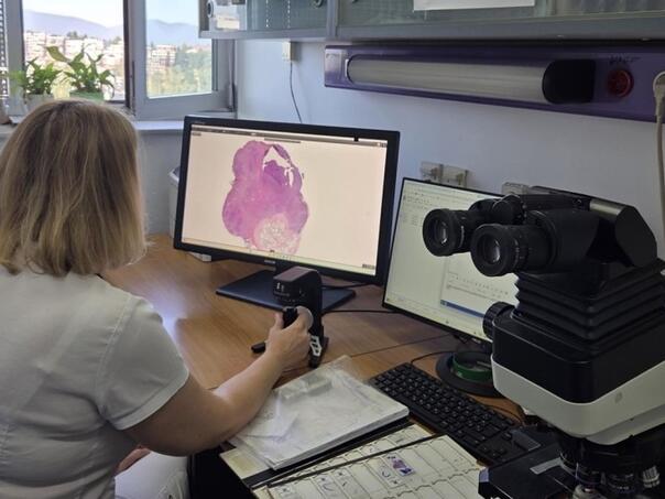 KCUS uvodi napredne AI alate za analizu uzoraka i personaliziranu terapiju