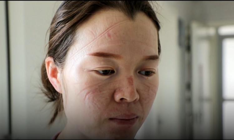 Kineski medicinski radnici naporno rade u borbi protiv koronavirusa