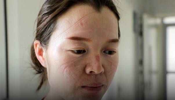 Kineski medicinski radnici naporno rade u borbi protiv koronavirusa