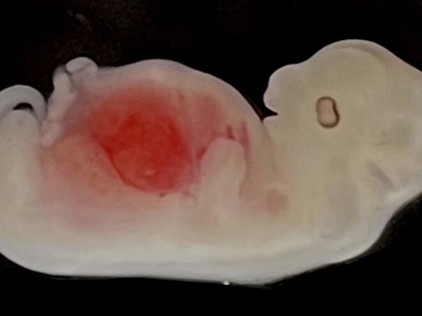 Kinezi razvili ljudski bubreg iz svinjskih embrija