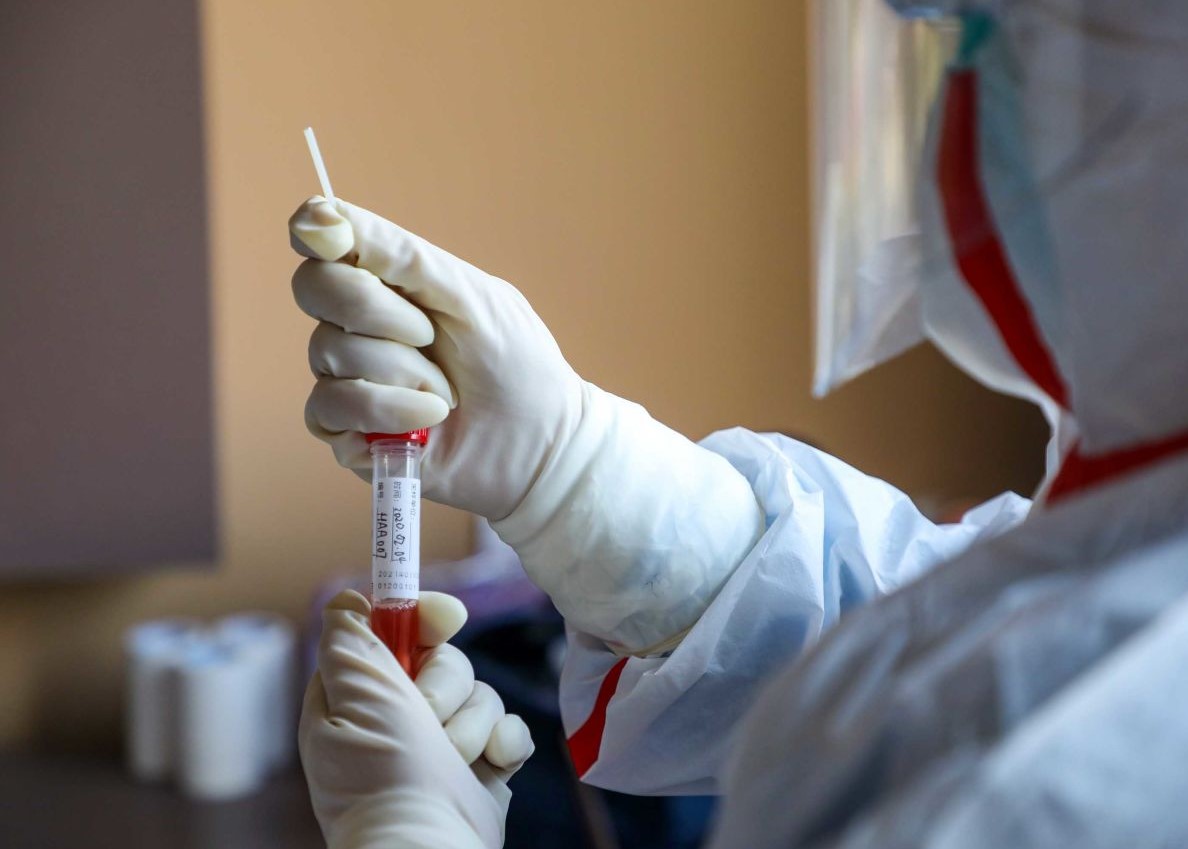 Kinezi sve više prijavljuju novi simptom COVID-a: Kako se zaštititi?