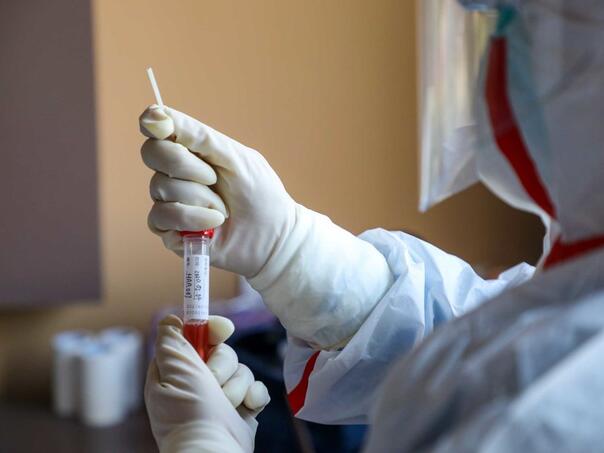 Kinezi sve više prijavljuju novi simptom COVID-a: Kako se zaštititi?