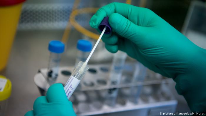RS: Kod 134 osobe potvrđen virus korona, osam umrlih