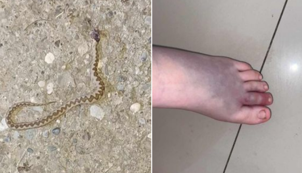 Kod Konjević Polja poskok ugrizao 12 - godišnjakinju