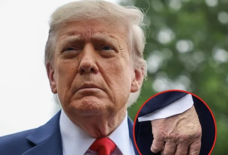 Koliko je ozbiljna dijagnoza Donalda Trumpa?