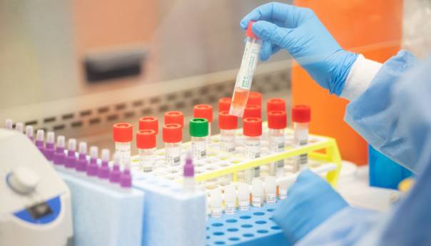 Korona u BiH: 12 umrlih, 334 novozaraženih