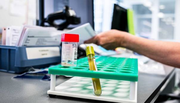 Korona virus u RS: 241 osoba pod nadzorom