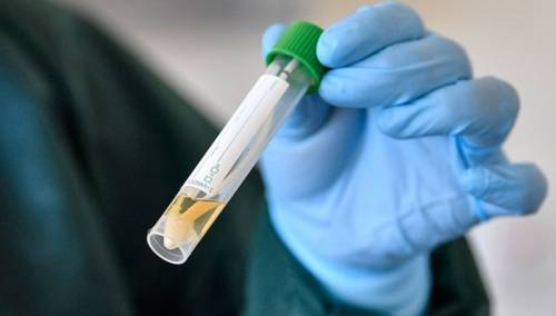 Koronavirus na čeličnim površinama opstaje i do 72 sata