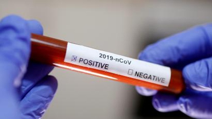 Koronavirus potvrđen kod još tri osobe iz Tuzle