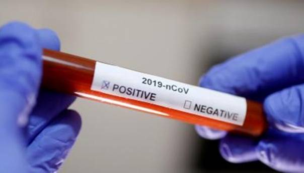 Koronavirus potvrđen kod još tri osobe iz Tuzle
