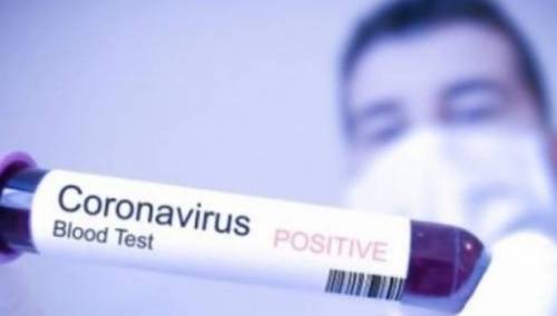 Koronavirus u RS - Pod zdravstvenim nadzorom 240 osoba