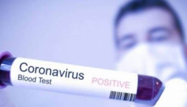 Koronavirus u RS - Pod zdravstvenim nadzorom 240 osoba