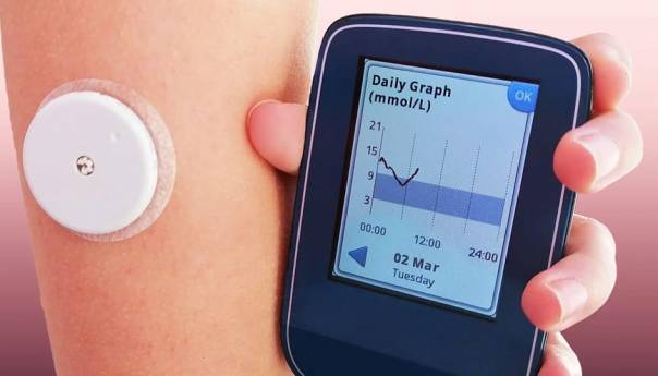 KS: Osigurani i senzori za mjerenje šećera u krvi za sve oboljele od dijabetesa tipa 1