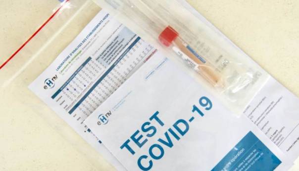 KS: Registrovana 81 novozaražena osoba, dvoje preminulo