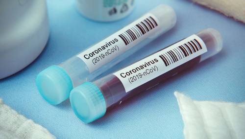 KS: U protekla 24 sata potvrđeno 209 novozaraženih, dvoje preminulo