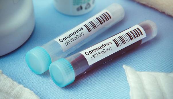 KS: U protekla 24 sata potvrđeno 209 novozaraženih, dvoje preminulo