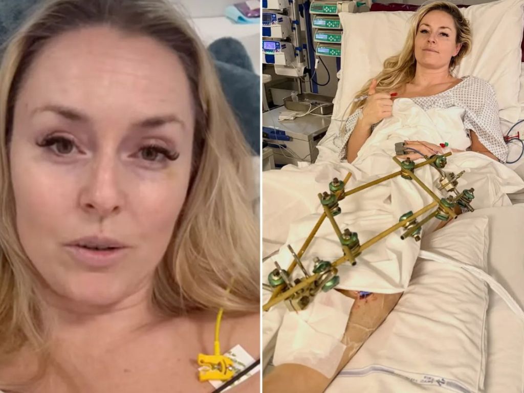 Lindsey Vonn mora na još dvije operacije