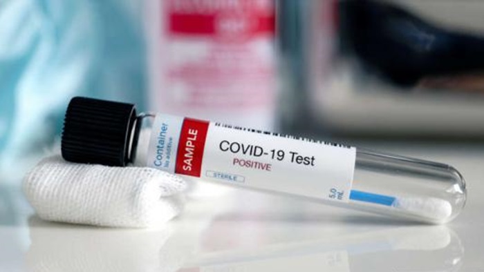 Ljudi koji su preboljeli covid-19 zaštićeni su do tri mjeseca