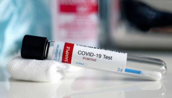 Ljudi koji su preboljeli covid-19 zaštićeni su do tri mjeseca