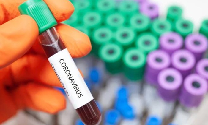 Luksemburg testira kompletno stanovništvo