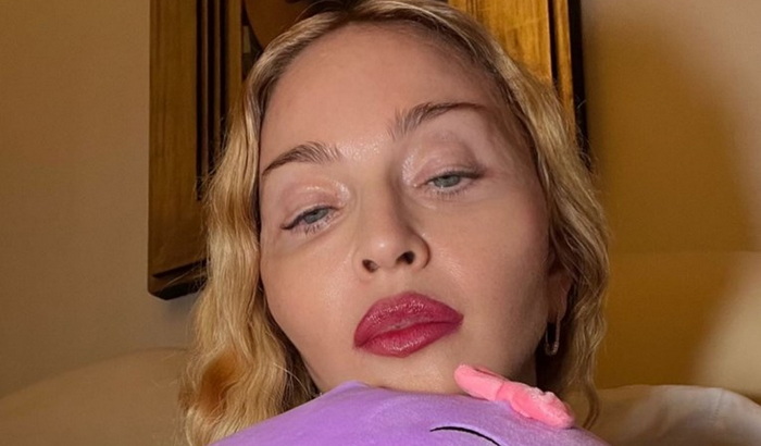 Madonna podijelila prve fotografije nakon izlaska iz bolnice